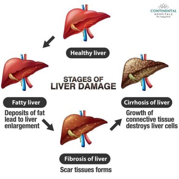 Can liver problems cause lip swelling?