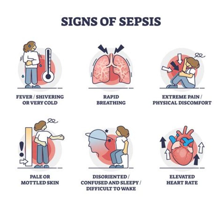 Can sepsis come on suddenly?