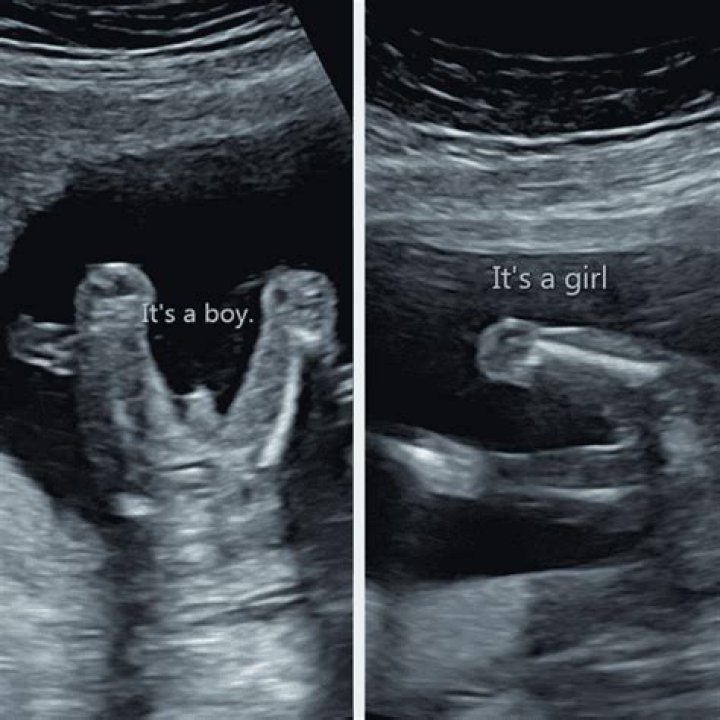 Can you find out the gender at 12 weeks?