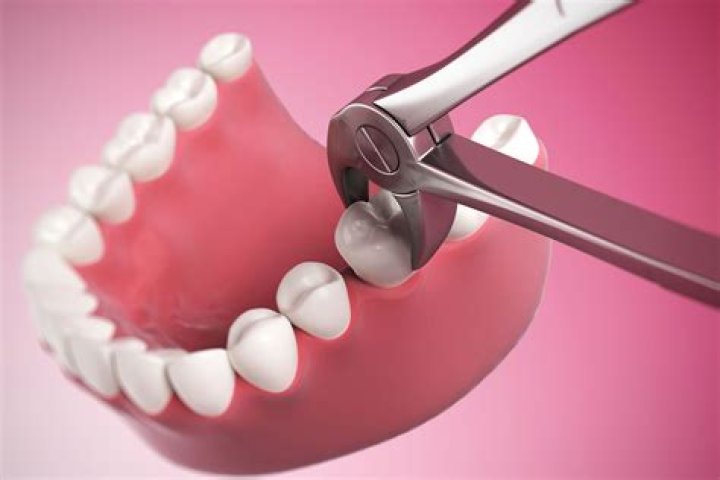 How do gums heal after crown?
