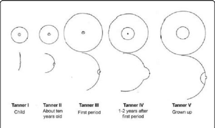 Is it normal for breasts to hurt at 11 years old?