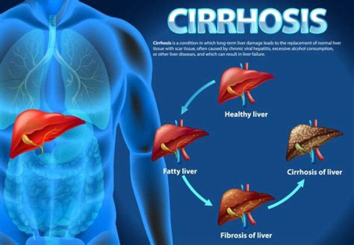 What does liver pain from cirrhosis feel like?