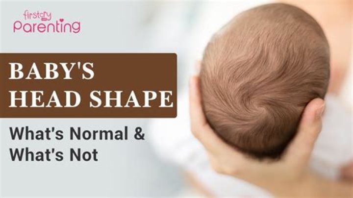 Why is my baby's head so veiny?